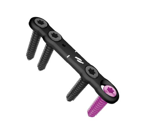 Osteotomieplatte für Vorfuß - Airlock® - novastep - mit Verriegelung / Metall
