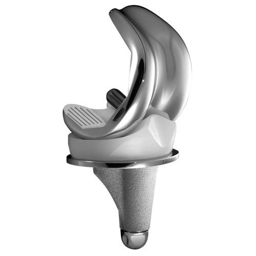 Femur-Patella Knieprothese - SCORE® - Amplitude Surgical - mit mobiler Scheibe