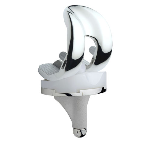 Femur-Patella Knieprothese - ANATOMIC® - Amplitude Surgical - posterior-stabilisiert, Schlitten / mit fester Scheibe