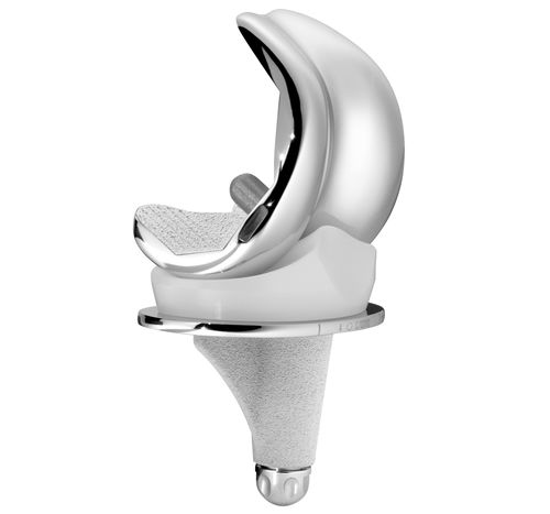 Femur-Patella Knieprothese - SCORE® II - Amplitude Surgical - mit mobiler Scheibe