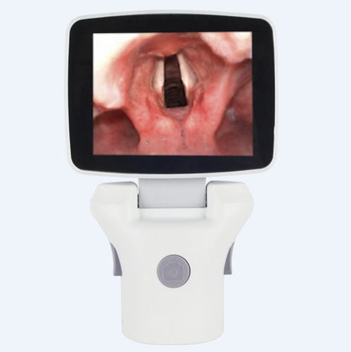 Video-Laryngoskop / mit integriertem Bildschirm - TL-100V-Ⅱ - Shenzhen Tianlang Medical Equipment - mit Klinge