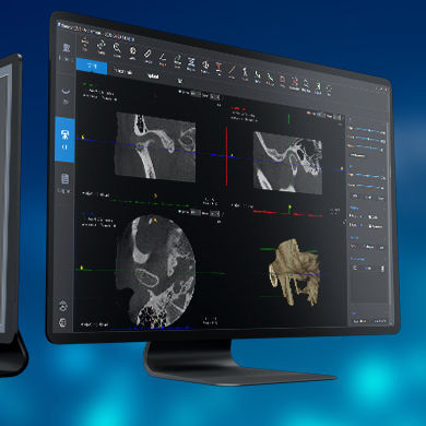 Medizinische Software - SmartV-ENT - LargeV Instrument - für Dentalimplantologie / für medizinische Bildgebung / HNO