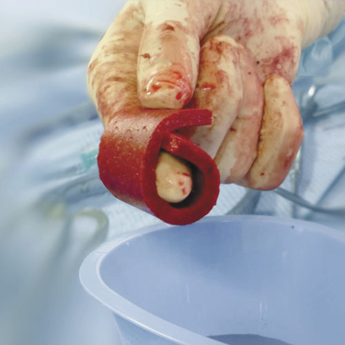 Xenograft-Knochenersatzmaterial - Cerasorb® Foam - Curasan - für orthopädische Chirurgie / formbar
