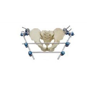 Fixateur externe / Becken - T8012 - Orthopromed - rohrförmig / für Erwachsene