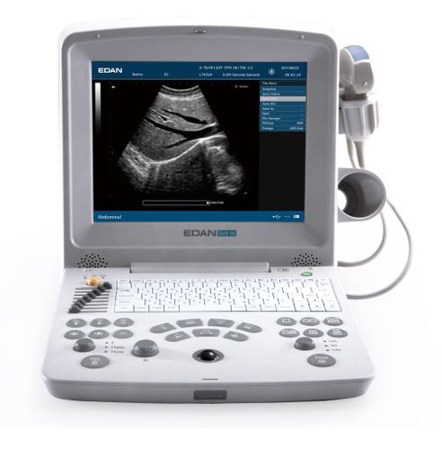 Tragbares Ultraschallgerät - DUS60 - JFB International - für Ultraschalldiagnostik in Gynäkologie und Geburtshilfe / für urologische Diagnostik / für Ultraschalluntersuchung von Muskeln und Skelett