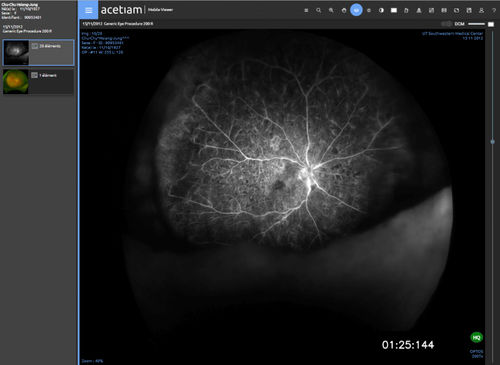Medizinische Software - vieviewer Clinic - NEHS DIGITAL - für Kliniken / universell / Viewer