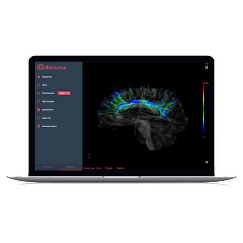 Bildanalyse-Software - Brainance MD  - Advantis Medical Imaging - Reporting / 3D-Visualisierung / DICOM-Visualisierung