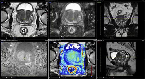 Analysesoftware - Advantis Medical Imaging - Reporting / Viewer / MRT