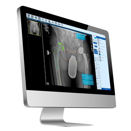 Medizinische Software - ZedView2.5D - LEXI Co. - für Krankenhaus / für Hüftchirurgie / Viewer