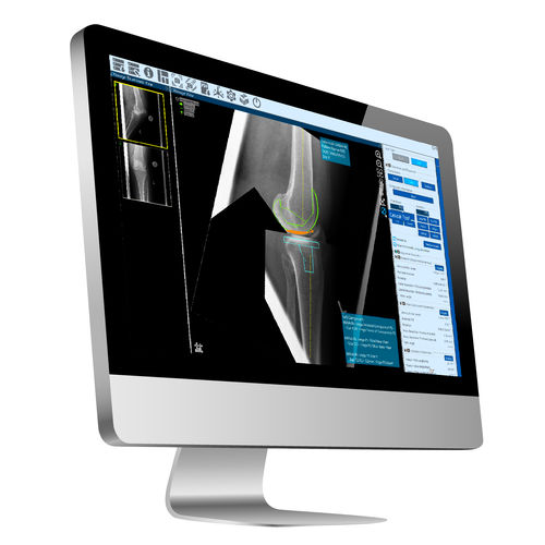 Software für orthopädische Chirurgie - ZedView2.5D - LEXI Co. - Viewer / Planung / Import