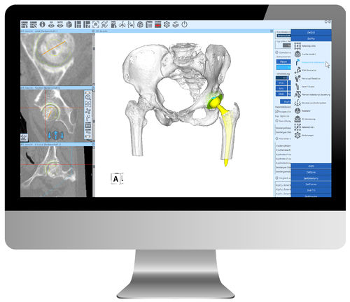 Software für Krankenhaus - ZedView - LEXI Co. - Computertomographie / für Hüftchirurgie / Analyse