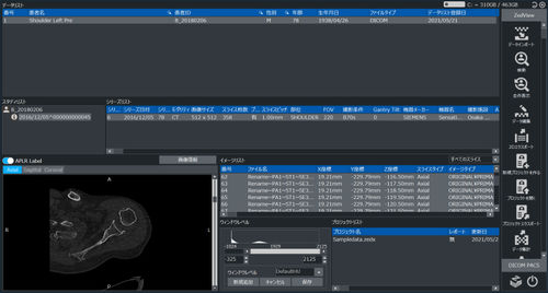 Medizinische Software - ZedView - LEXI Co. - Computertomographie / Schulterchirurgie / Viewer
