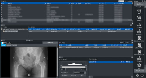 Medizinische Software - ZedView2.5D  - LEXI Co. - für Traumatologie / Viewer / Planung