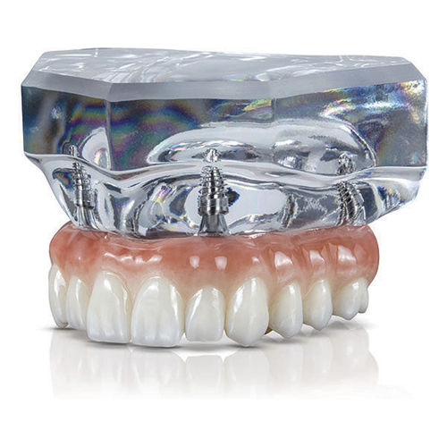 Anatomisches Modell / Dental - BruxZir® - Glidewell Direct - für Implantologie / für Vorführzwecke