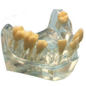 Anatomisches Modell / Kiefer - DM – 2002 - Selmodels SL - für Zahnchirurgie / für Implantologie / transparent