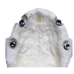 Anatomisches Modell / Dental - DM – 48 - Selmodels SL - für Implantologie