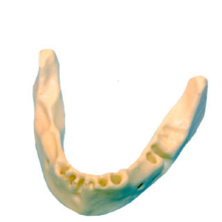 Anatomisches Modell / Knochen - DM – 608  - Selmodels SL - Unterkiefer / für Implantologie
