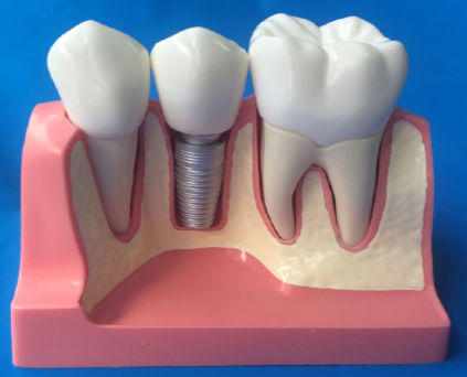 Anatomisches Modell / Dental - MM-101 - Selmodels SL - für Implantologie / flexibel