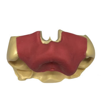 Sinusales anatomisches Modell - ZYG - 102  - Selmodels SL - für Zahnchirurgie / für Sinuslift