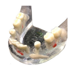 Anatomisches Modell / Unterkiefer - APIC-3 - Selmodels SL - Zahn / für Zahnextraktion / transparent