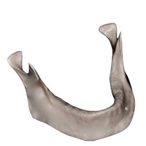 Anatomisches Modell / Knochen - DM – 201 - Selmodels SL - Unterkiefer / für Implantologie
