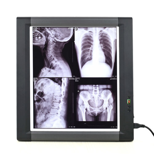 Digitaler Röntgenfilmbetrachter - MG01 - Nanchang Micare Medical Equipment - 1 Betrachtungsfläche / mit Schalter / LED