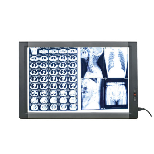 Digitaler Röntgenfilmbetrachter - MG02 - Nanchang Micare Medical Equipment - 2 Betrachtungsflächen / mit Schalter / LED