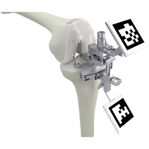 ACL-Bewegung-Analysesystem - PIXEE KNEE + - Gruppo Bioimpianti - für Kniegelenkkinematik / mit 3D-Anzeige
