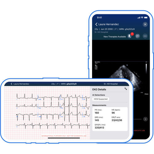 Mobile Applikation / Umform - Viz.ai - Reporting / Diagnose / für EKG