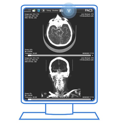 PACS mit Cloud Computing - Viz.ai - für medizinische Bildgebung / medizinisch