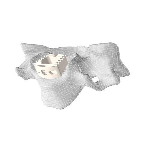 HWS-Zwischenwirbelimplantat - CL5™ - Corelink Surgical - ventraler Zugang / aus PEEK