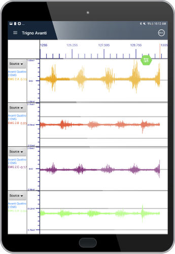 Software-Modul / für EMG - EMG Plots - Delsys - Visualisierung / Behandlungsplanung / Ausbildung