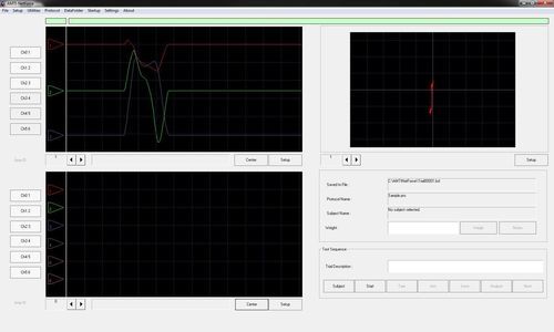 Software zur Bewertung der Gangart - NetForce - AMTI - Rehabilitation / für Posturographie / Physiotherapie