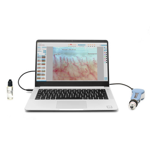 Videokapillaroskop - DM-120 CapiScope series - Inspectis - für PCs