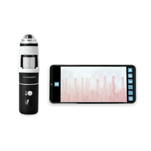Videokapillaroskop - DM-110 DigiScope - Inspectis - für Smartphone / für Tablet