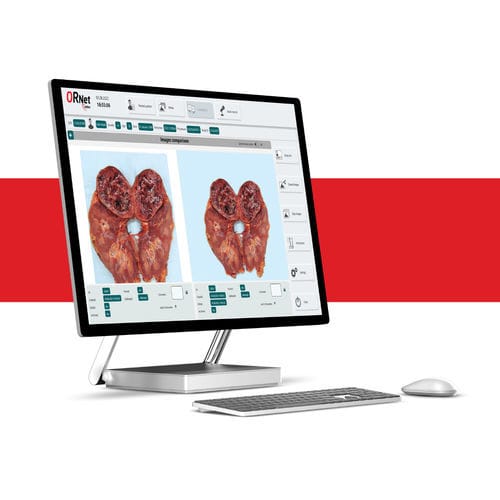 Medizinische Software - Editor - Bait Partner - für Kliniken / OP / für OP-Saal