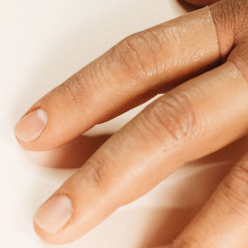 Kosmetische Fingerprothese - MasCapacidad - für Erwachsene