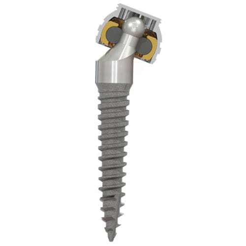 Titan-Zahnimplantat - SATURNO® - Zest Dental Solutions - Kugel / gewinkelt / schmal
