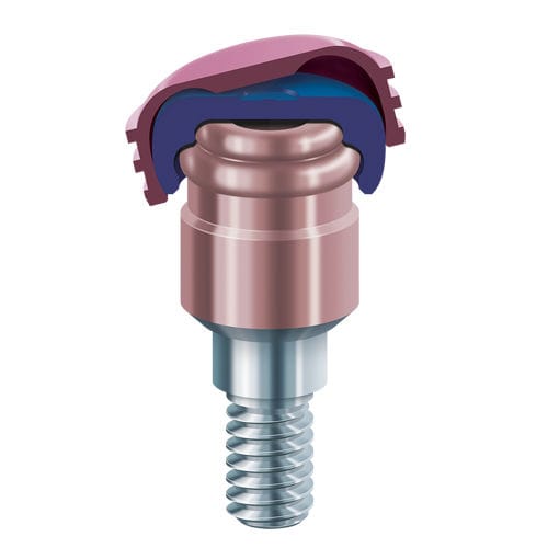 Implantat-Aufbau Pfosten Kit / Titan - LOCATOR R-Tx® - Zest Dental Solutions - anatomisch / Locator®