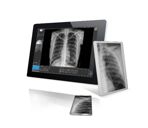 Imager - AVANSE DR - Visaris