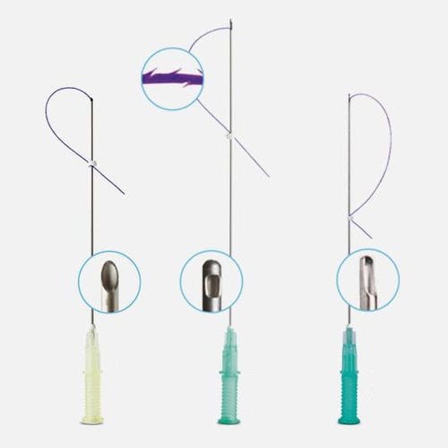 Resorbierbarer Liftingfaden - COG Pro series - W&O medical esthetics - gezackt / glatt