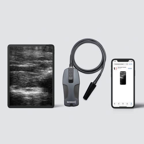 Tragbares Tierärztliches Ultraschallsystem - BL Tecnoscan - Tecnovet - Multifunktion / drahtlose Sonde