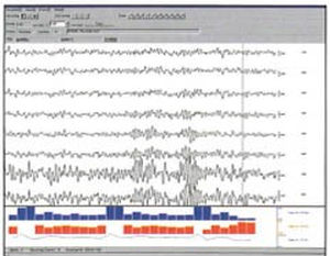 Analysesoftware - SleepSign™ - Muromachi Kikai - für EMG / für Tierarztpraxis