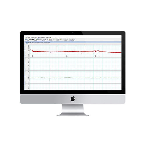 Analysesoftware - Danish Myo Technology A.S (DMT) - Beschaffung / medizinisch