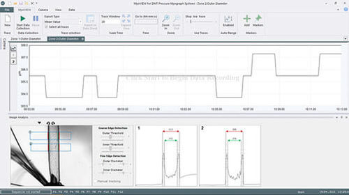 Analysesoftware - MyoVIEW - Danish Myo Technology A.S (DMT) - Management / Steuerung / Beschaffung