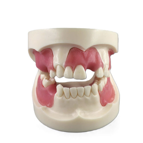 Anatomisches Modell / Knochen - G-Y28 - FOSHAN JINGLE MEDICAL EQUIPMENT CO., LTD - Gebiss / für Implantologie / Ausbildung