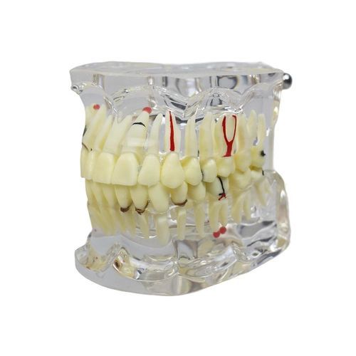 Anatomisches Modell / Gebiss - JG-Y15-IM - FOSHAN JINGLE MEDICAL EQUIPMENT CO., LTD - Wurzelkanal / Dental / Harz