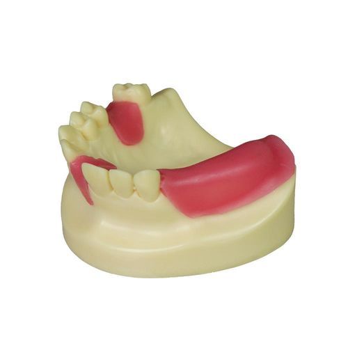 Anatomisches Modell / Dental - JG-Y8-F11 - FOSHAN JINGLE MEDICAL EQUIPMENT CO., LTD - Zahnfleisch / Knochen / für Implantologie