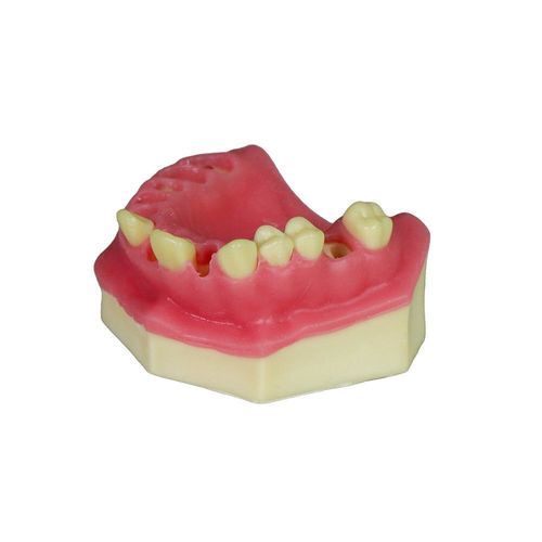 Gingivales anatomisches Modell - JG-Y8-F3 - FOSHAN JINGLE MEDICAL EQUIPMENT CO., LTD - Knochen / chirurgisch / Ausbildung