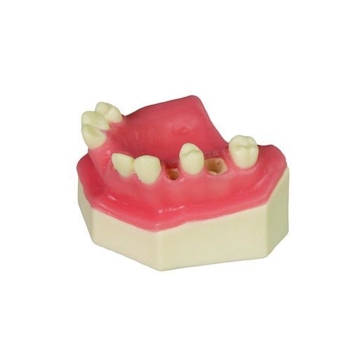 Anatomisches Modell / Dental - JG-YZ-15 - FOSHAN JINGLE MEDICAL EQUIPMENT CO., LTD - gingival / Knochen / chirurgisch